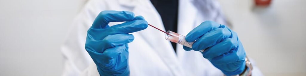 Servicio de diagnóstico y asesoramiento para el control de enfermedades parasitarias animales