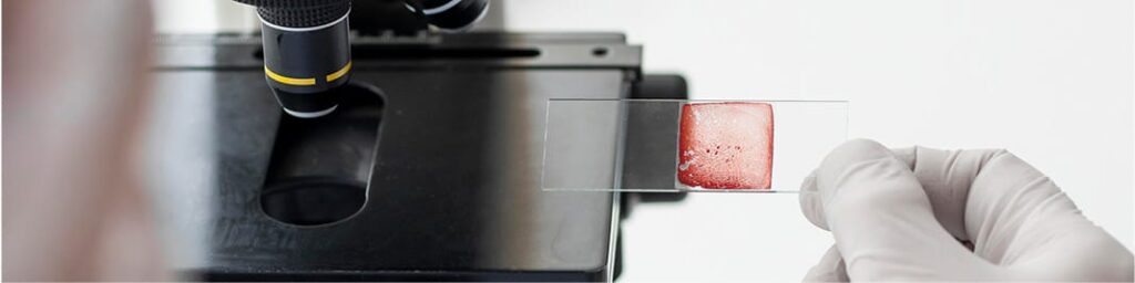 Servicio de diagnóstico y asesoramiento para el control de enfermedades parasitarias animales